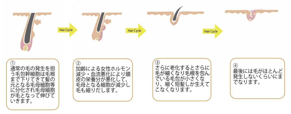 女性が薄毛で悩む原因は何 新習慣で薄毛対策 天使のおまもりスカルプ美容液 Genpress